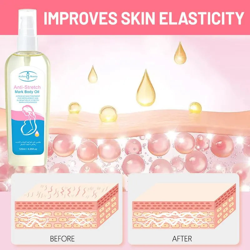 Aichun Beauty Anti Stretch Mark Body Oil - 120ml - Buy Online in Pakistan at Cosmia.pk