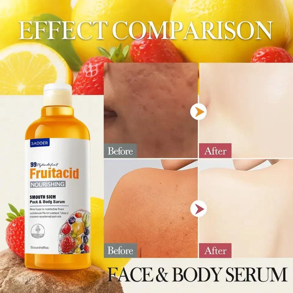 Sadoer Fruit Acid Face & Body Serum - 500ml - Buy Online in Pakistan at Cosmia.pk