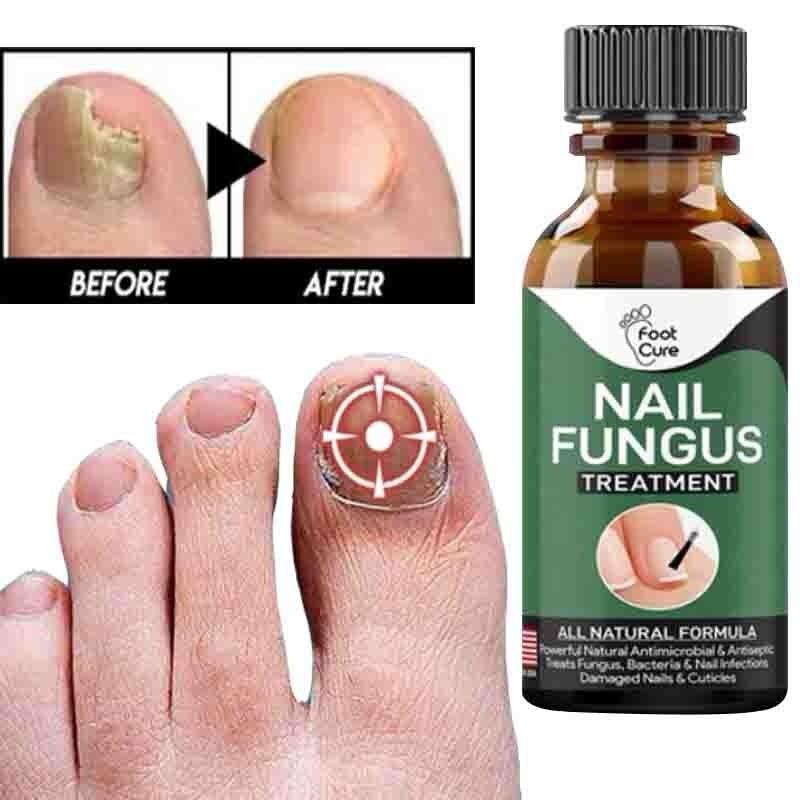 Fast Nail Fungal Treatments Nail Repair Essences Serum - Buy Online in Pakistan at Cosmia.pk