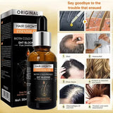 Hair Growth Essential Oil – Biotin Cold-Pressed DHT Blocker – 30ml - Buy Online in Pakistan at Cosmia.pk