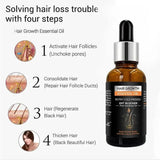 Hair Growth Essential Oil – Biotin Cold-Pressed DHT Blocker – 30ml - Buy Online in Pakistan at Cosmia.pk