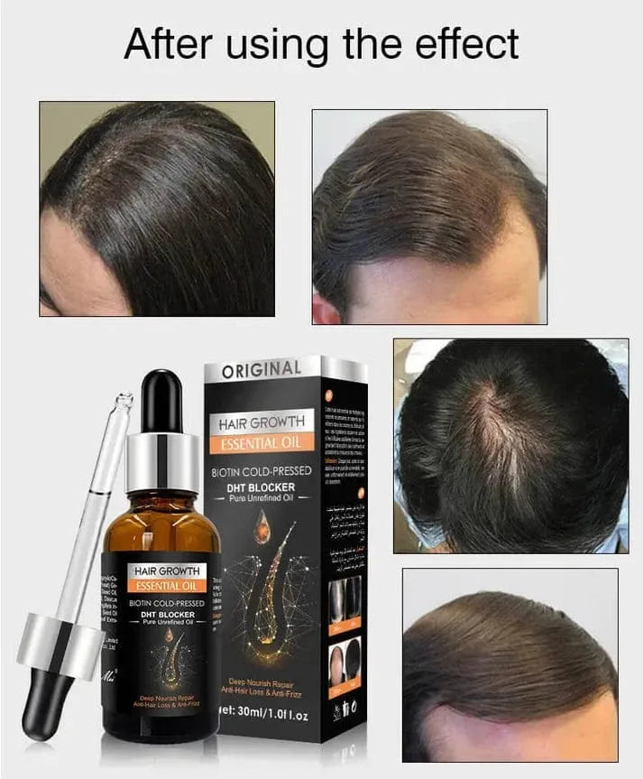 Hair Growth Essential Oil – Biotin Cold-Pressed DHT Blocker – 30ml - Buy Online in Pakistan at Cosmia.pk