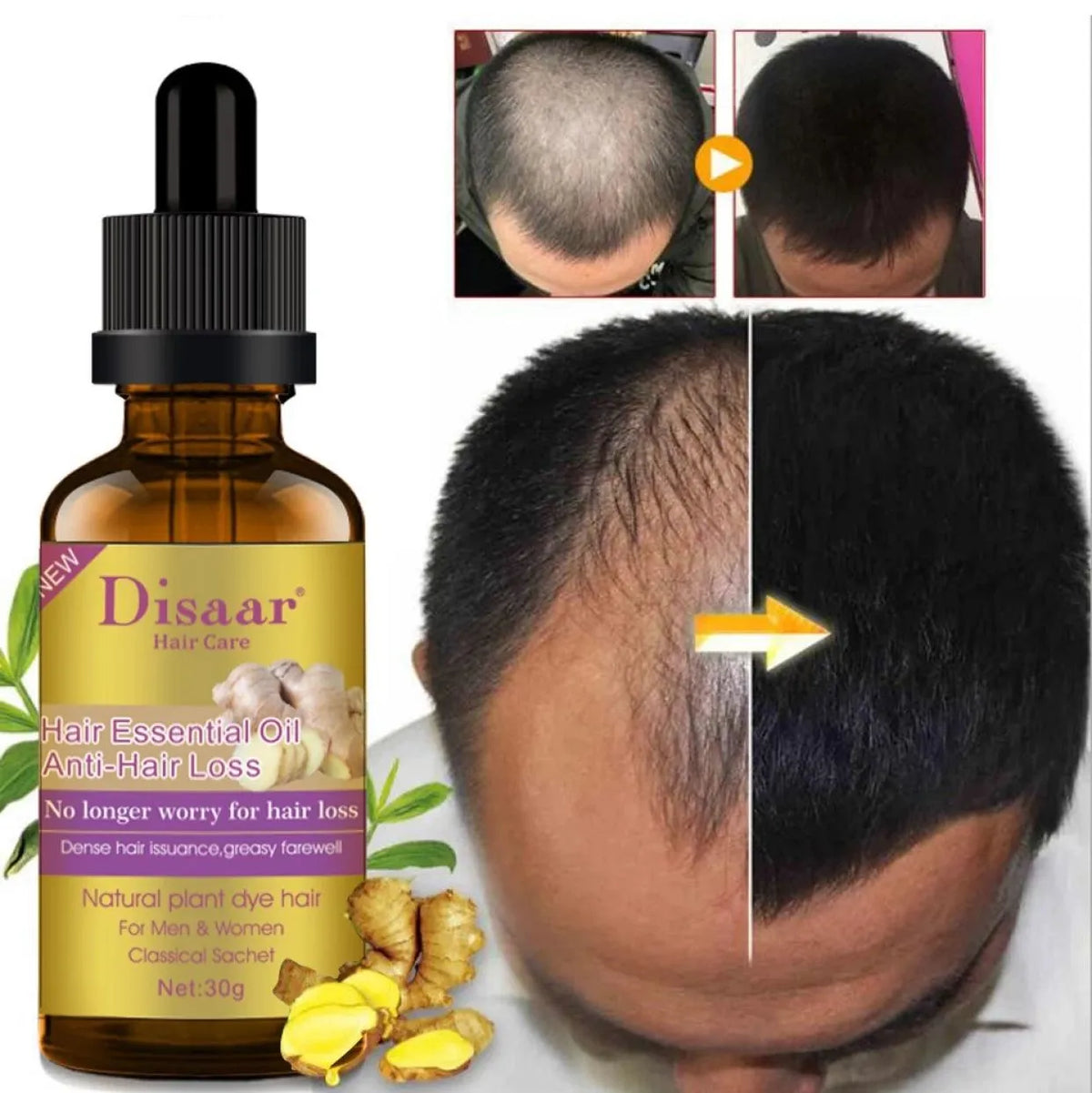 Disaar Anti-Hair Loss Ginger Oil – 30g - Buy Online in Pakistan at Cosmia.pk