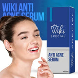 Wiki Special Anti Acne Serum - 30ml - Buy Online in Pakistan at Cosmia.pk