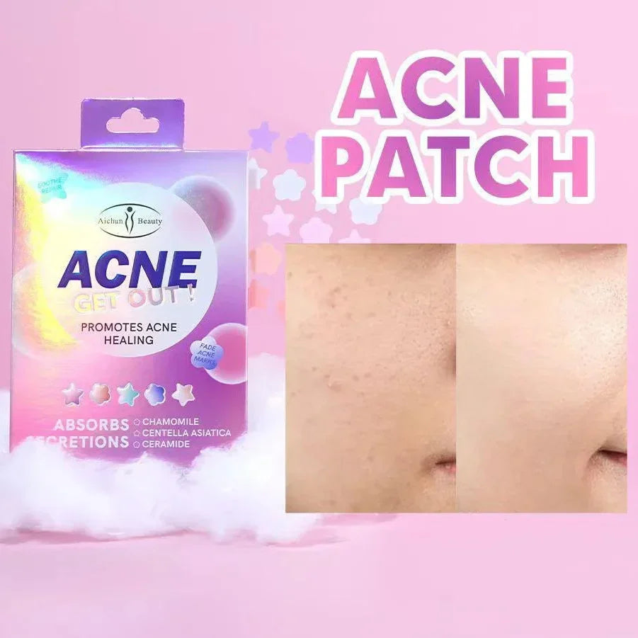 Aichun Beauty Acne Get Out! Patches - Each - Buy Online in Pakistan at Cosmia.pk