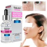 Kojic Acid Whitening Facial Serum - 30ml - Buy Online in Pakistan at Cosmia.pk