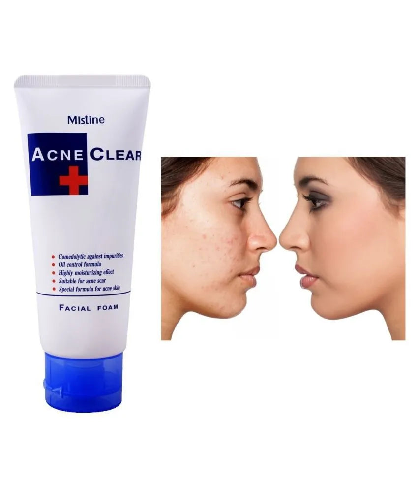 Mistine Acne Clear Facial Foam - 85ml - Buy Online in Pakistan at Cosmia.pk