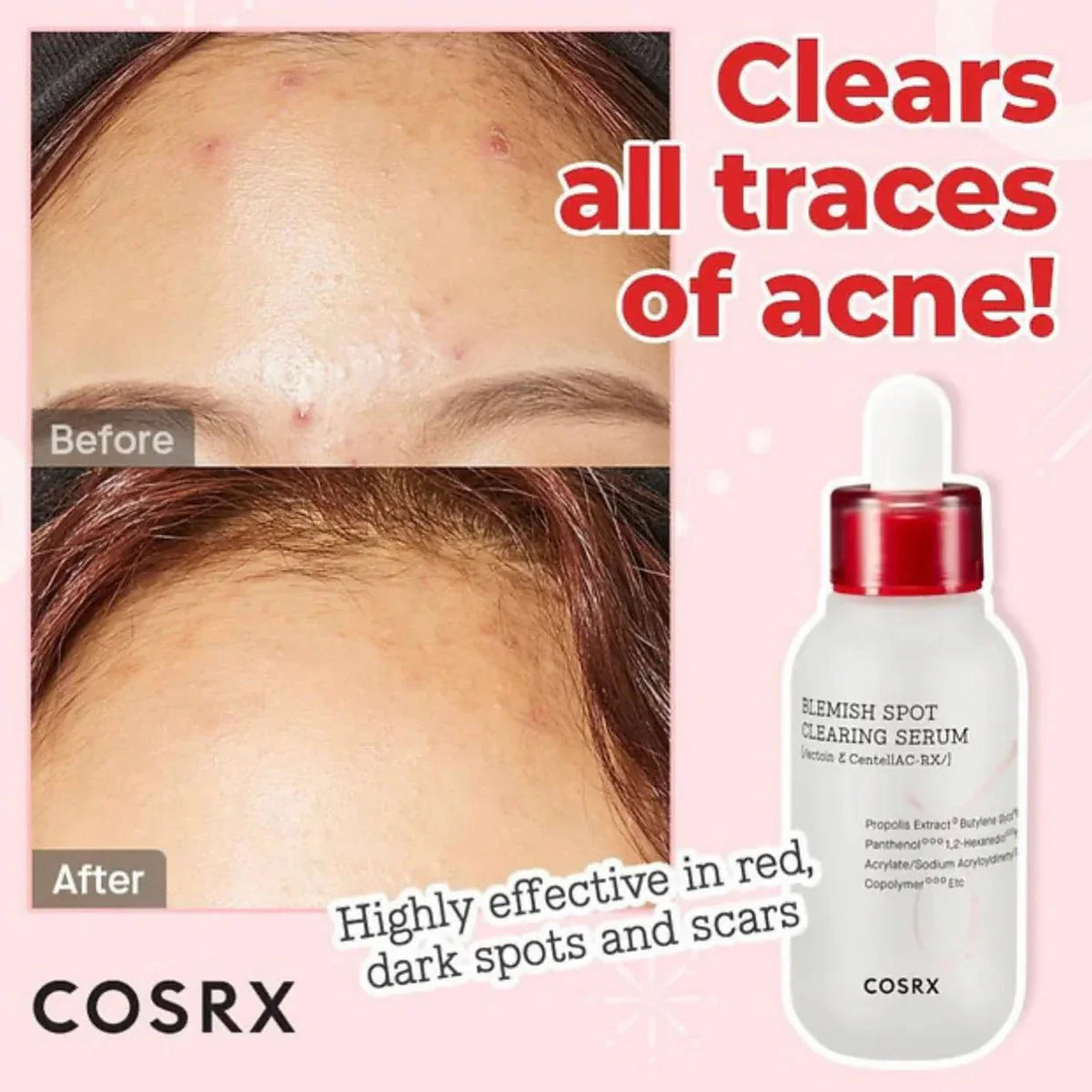 Cosrx Blemish Spot Clearing Serum - 40ml - Buy Online in Pakistan at Cosmia.pk