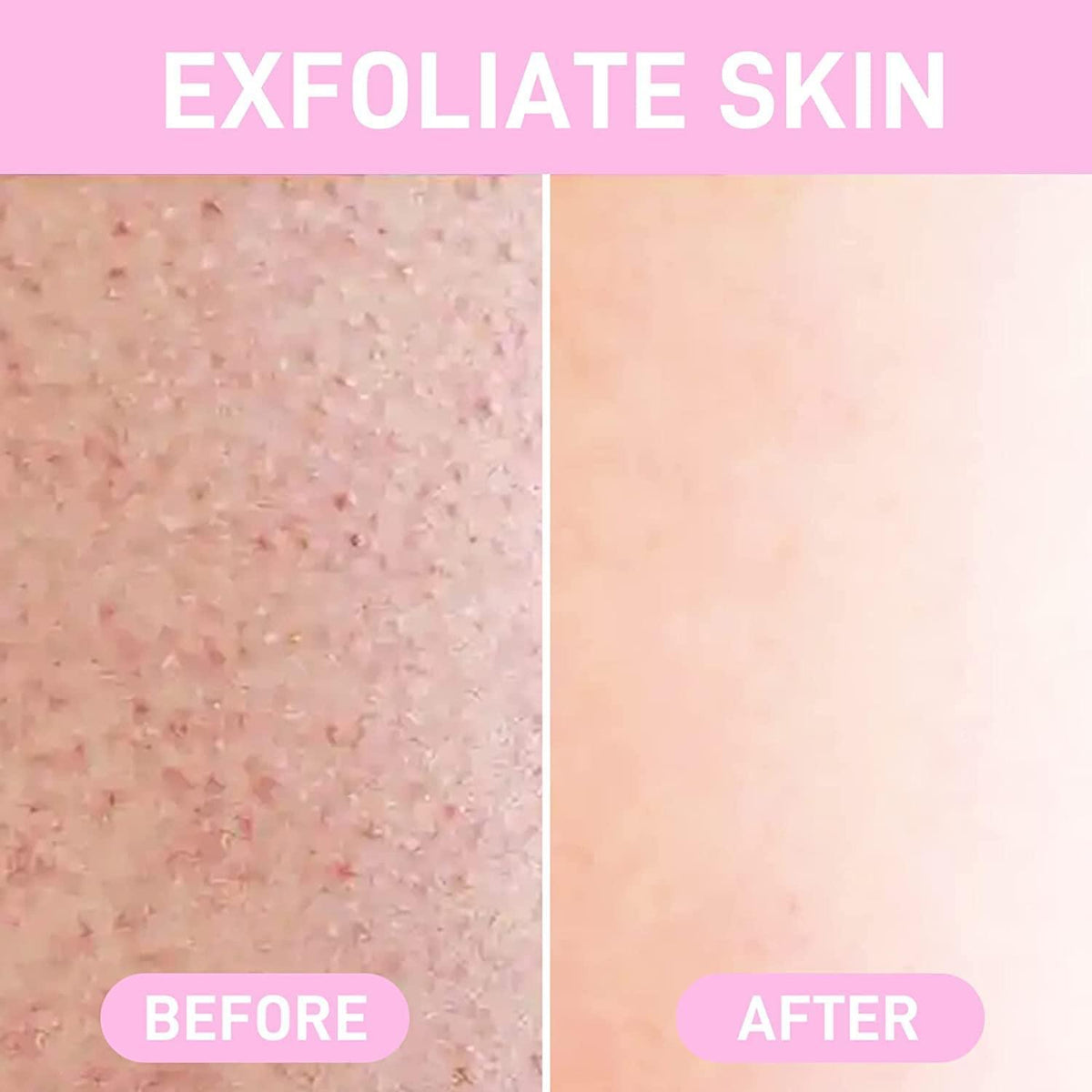 hair removal Crystal - 100% Original - Buy Online in Pakistan at Cosmia.pk