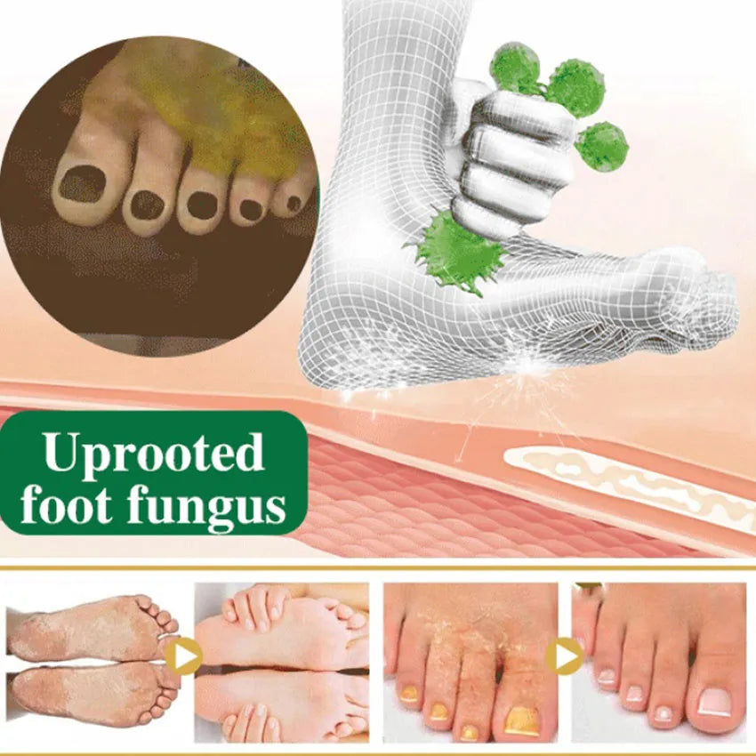 Athlete's Foot Herbal Antibacterial Spray - Buy Online in Pakistan at Cosmia.pk
