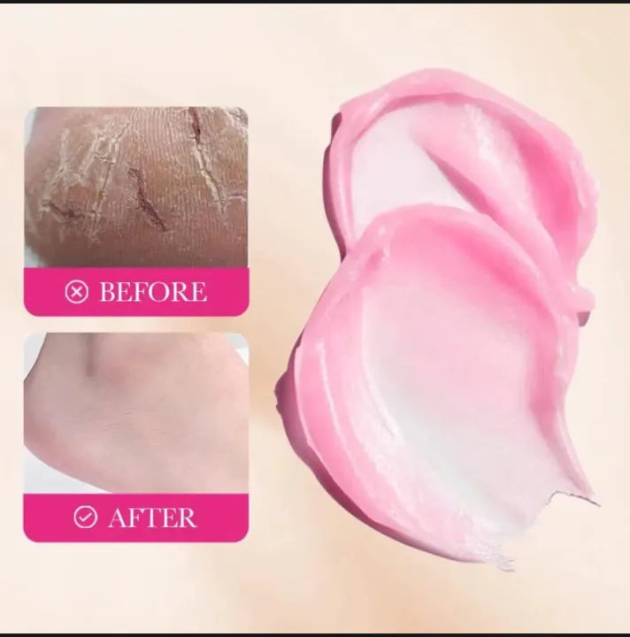 Sadoer Anti Crack Squalene Peach Repair Cream 70g - Buy Online in Pakistan at Cosmia.pk