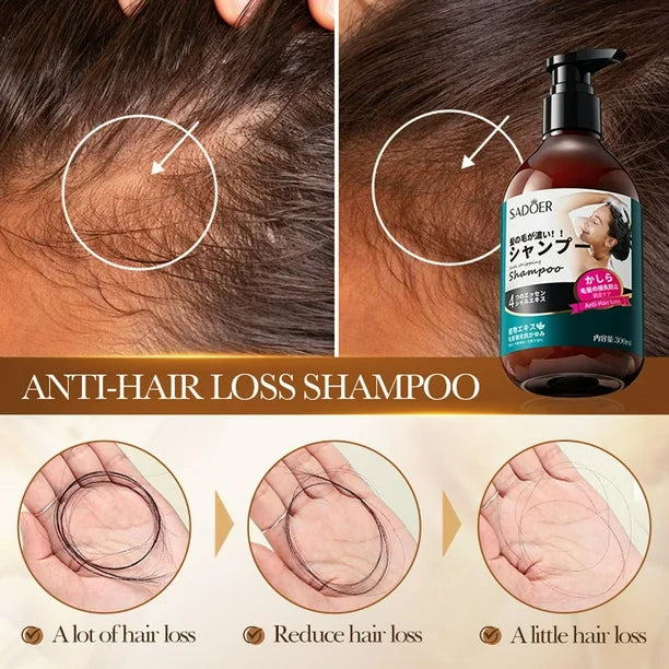 SADOER Anti Hair Loss Shampoo Anti-dandruff Hair Growth Shampoo - 300ml - Buy Online in Pakistan at Cosmia.pk