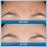 CeraVe Resurfacing Retinol Serum – 30ml - Buy Online in Pakistan at Cosmia.pk