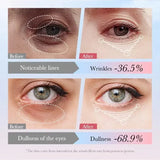 SADOER 4in1 Roll-on Moisturizing Eye Cream - 20gm - Buy Online in Pakistan at Cosmia.pk