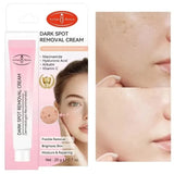 Aichun Beauty Dark Spot Removal Cream - Each - Buy Online in Pakistan at Cosmia.pk