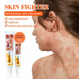 Skin Fighter Herbal Repair Ointment - Each - Buy Online in Pakistan at Cosmia.pk