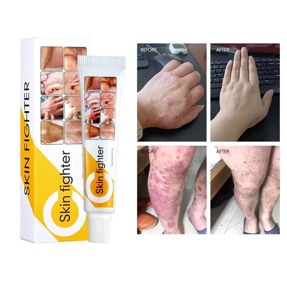 Skin Fighter Herbal Repair Ointment - Each - Buy Online in Pakistan at Cosmia.pk