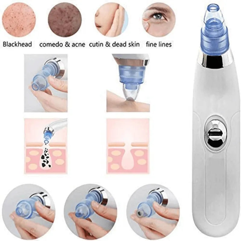 DermaSuction Cell Operated Blackhead Remover with 4 Suction Heads - Buy Online in Pakistan at Cosmia.pk