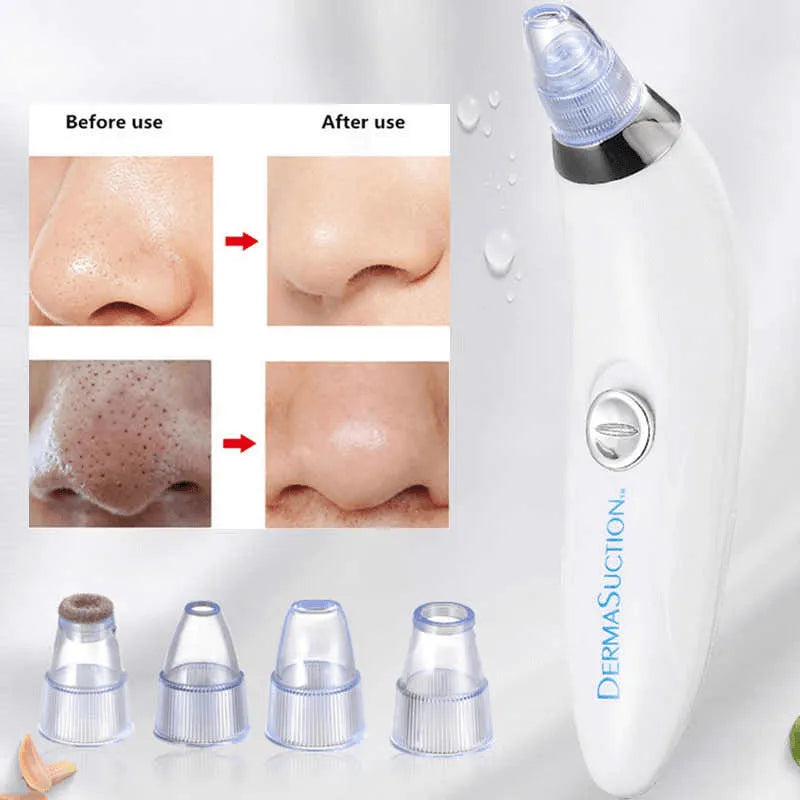 DermaSuction Cell Operated Blackhead Remover with 4 Suction Heads - Buy Online in Pakistan at Cosmia.pk