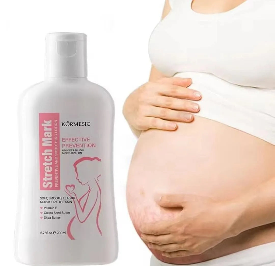 KORMESIC Stretch Mark Care Lotion – 200ml - Buy Online in Pakistan at Cosmia.pk