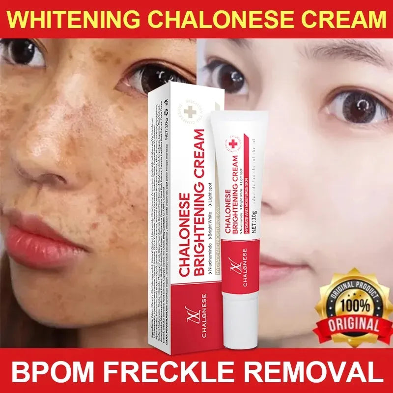 CHALONESE Brightening Cream Serum – 20g - Buy Online in Pakistan at Cosmia.pk