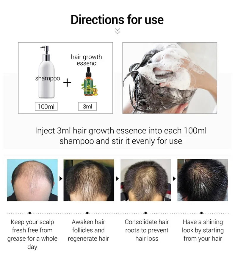 Aichun Beauty 7 Days Ginger Hair Growth Oil Serum For Damaged Hair - Buy Online in Pakistan at Cosmia.pk