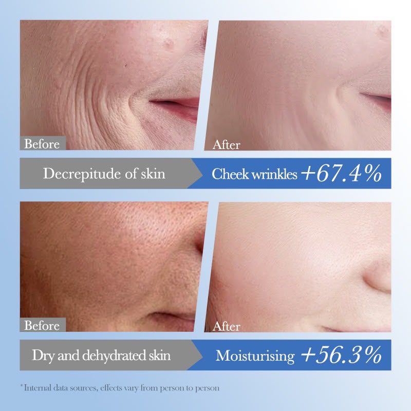 Sadoer caviar cleanser before after results — fewer cheek wrinkles, moisturised skin