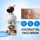 SADOER Coconut Oil Face Serum 40ml bottle with before and after skin results