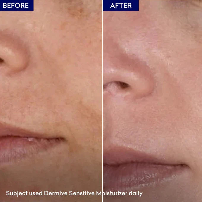 Dermive Sensitive Moisturizer Soothes Skin | Relieves Itching - 100ml - Buy Online in Pakistan at Cosmia.pk