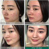 SOMEBYMI - AHA BHA PHA 30 Days Miracle Toner - 150 ml SOMEBYMI