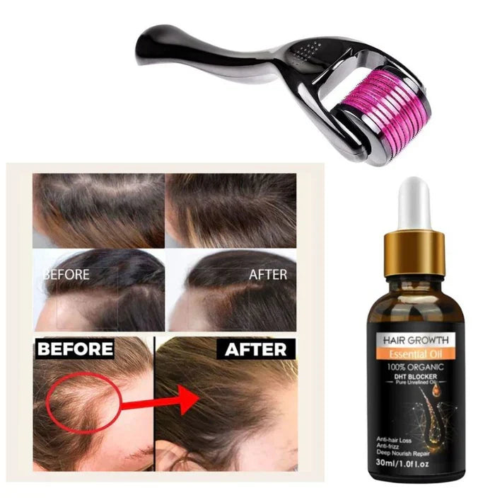 Pack Of 02 Hair Growth Oil Derma Roller - 0.55mm - Buy Online in Pakistan at Cosmia.pk